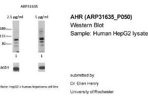 Western Blotting (WB) image for anti-Aryl Hydrocarbon Receptor (AHR) (N-Term) antibody (ABIN2777386) (Aryl Hydrocarbon Receptor anticorps  (N-Term))