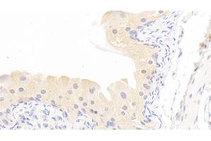 Detection of MMP13 in Rabbit Bladder Tissue using Polyclonal Antibody to Matrix Metalloproteinase 13 (MMP13) (MMP13 anticorps  (AA 70-245))