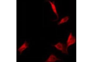 anti-Cytochrome B-561 Domain Containing 2 (CYB561D2) antibody