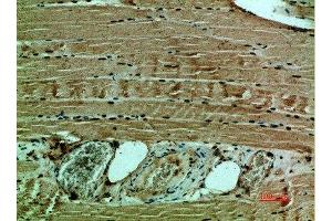 Immunohistochemical analysis of paraffin-embedded human-muscle, antibody was diluted at 1:200 (COL12A1 anticorps  (AA 1268-1341))