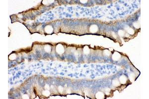 Anti- Villin Picoband antibody,IHC(P) IHC(P): Rat Intestine Tissue (Villin 1 anticorps  (C-Term))