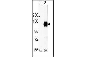Western blot analysis of EphA2 (arrow) using rabbit polyclonal EphA2 Antibody (EPH Receptor A2 anticorps  (C-Term))