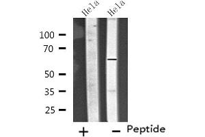 Western blot analysis of extracts from Hela cells, using CP26C antibody. (CYP26C1 anticorps  (Internal Region))