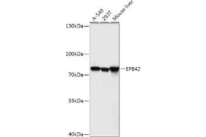 Western blot analysis of extracts of various cell lines, using EPB42 antibody (ABIN7267007) at 1:1000 dilution. (EPB42 anticorps  (AA 10-240))