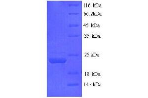 SDS-PAGE (SDS) image for Leukocyte Immunoglobulin-Like Receptor B3 (LILRB3) (AA 664-841), (Cytoplasmic Domain), (Cytosolic) protein (His tag) (ABIN5713612)