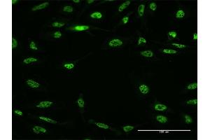 Immunofluorescence of monoclonal antibody to RBM5 on HeLa cell. (RBM5 anticorps  (AA 75-184))