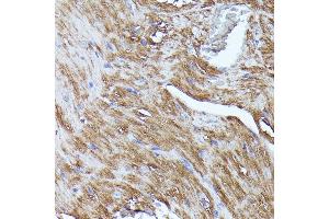 Immunohistochemistry of paraffin-embedded mouse heart using N-WASP/WASL antibody (ABIN3016273, ABIN3016274, ABIN3016275, ABIN1683282 and ABIN6219682) at dilution of 1:100 (40x lens). (Neural Wiskott-Aldrich syndrome protein (WASL) (AA 1-250) anticorps)