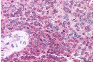 Human Spleen (formalin-fixed, paraffin-embedded) stained with TRIM32 antibody ABIN213721 at 2.