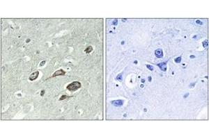 Immunohistochemistry analysis of paraffin-embedded human brain, using Calmodulin (Phospho-Thr79+Ser81) Antibody.