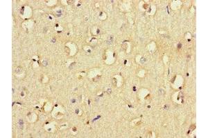 Immunohistochemistry of paraffin-embedded human brain tissue using ABIN7158541 at dilution of 1:100