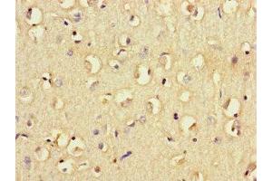 Immunohistochemistry of paraffin-embedded human brain tissue using ABIN7158541 at dilution of 1:100 (FCGR2B anticorps  (AA 12-289))