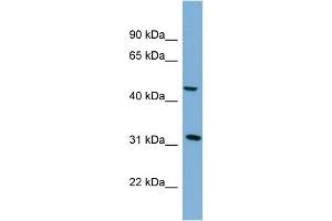 WB Suggested Anti-SERPINI2 Antibody Titration: 0. (SERPINI2 anticorps  (Middle Region))