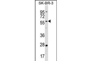 TAF6L Antibody (N-term) (ABIN1539596 and ABIN2838215) western blot analysis in SK-BR-3 cell line lysates (35 μg/lane). (TAF6L anticorps  (N-Term))