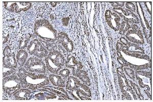IHC analysis of Serum Response Factor/SRF using anti-Serum Response Factor/SRF antibody (ABIN7600213).