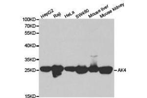 Western Blotting (WB) image for anti-Adenylate Kinase 4 (AK4) antibody (ABIN1870894) (AK4 anticorps)