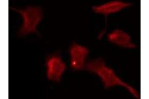 ABIN6276054 staining COLO205 by IF/ICC.