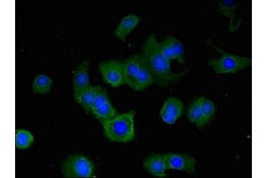 Immunofluorescent analysis of MCF-7 cells using ABIN7168188 at dilution of 1:100 and Alexa Fluor 488-congugated AffiniPure Goat Anti-Rabbit IgG(H+L)