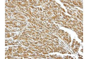 IHC-P Image Immunohistochemical analysis of paraffin-embedded U87 xenograft, using HSC70, antibody at 1:100 dilution.