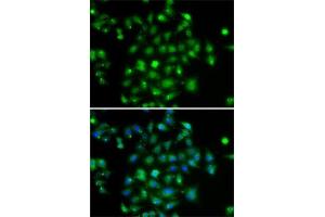 Immunofluorescence analysis of A-549 cells using DYRK2 antibody (ABIN6130879, ABIN6139897, ABIN6139898 and ABIN6222785).