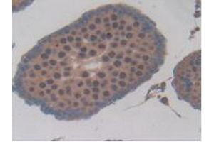 Detection of HK1 in Rat Testis Tissue using Polyclonal Antibody to Hexokinase 1 (HK1)