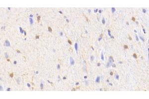 Detection of GS in Human Cerebellum Tissue using Polyclonal Antibody to Glutamine synthetase (GS) (GLN1 anticorps  (AA 1-373))