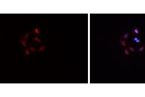 ABIN6269069 staining HepG2? (SNAIL anticorps  (C-Term))