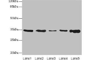 Western blot All lanes: UCP3 antibody at 0. (UCP3 anticorps  (AA 33-76))