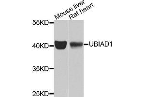 Western blot analysis of extracts of mouse liver and rat heart tissues, using UBIAD1 antibody.