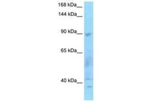 Image no. 1 for anti-SECIS Binding Protein 2 (SECISBP2) (AA 159-208) antibody (ABIN6748255) (SECISBP2 anticorps  (AA 159-208))
