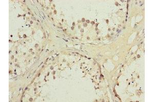 Immunohistochemistry of paraffin-embedded human testis tissue using ABIN7142330 at dilution of 1:100 (AKR1D1 anticorps  (AA 1-200))