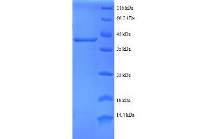 RPS24 Protein (AA 2-133, partial) (GST tag)