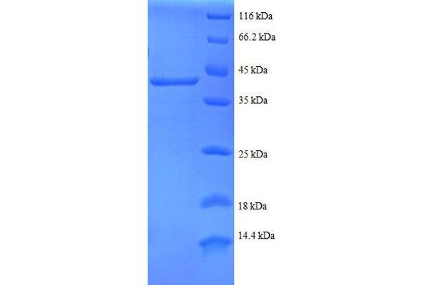 RPS24 Protein (AA 2-133, partial) (GST tag)
