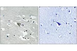 Immunohistochemistry analysis of paraffin-embedded human brain, using VEGFR1 (Phospho-Tyr1048) Antibody. (FLT1 anticorps  (pTyr1048))