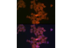 Immunofluorescence analysis of HeLa cells using PFDN5 Rabbit mAb (ABIN1682853, ABIN3018535, ABIN3018536 and ABIN7101624) at dilution of 1:100 (40x lens).