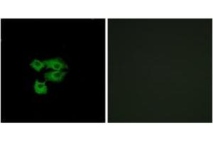 Immunofluorescence analysis of A549 cells, using LY6E Antibody. (LY6E anticorps  (AA 17-66))