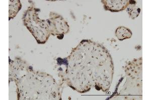 Immunoperoxidase of monoclonal antibody to ZIC4 on formalin-fixed paraffin-embedded human placenta.