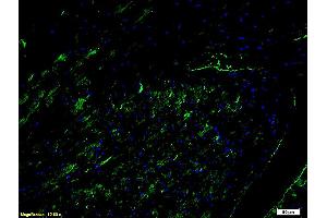 Formalin-fixed and paraffin embedded mouse heart tissue labeled with Anti-CD54 ICAM-1 Polyclonal Antibody, unconjugated (ABIN670806) at 1: 200,followed by incubation with conjugated secondary antibody (Goat Anti-Rabbit IgG, PE conjugated at 1: 200 for 40 minutes at 37°C).