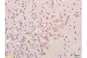 Formalin-fixed and paraffin embedded rat brain labeled with Rabbit Anti CaMK2 alpha Polyclonal Antibody, Unconjugated (ABIN1386359) at 1:200 followed by conjugation to the secondary antibody and DAB staining (CAMK2B anticorps  (AA 101-200))