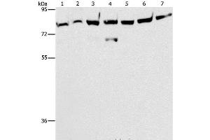 Western Blot analysis of A172 cell and Mouse brain tissue, K562, 231, A549, hela and hepG2 cell using PKC epsilon Polyclonal Antibody at dilution of 1:400 (PKC epsilon anticorps)