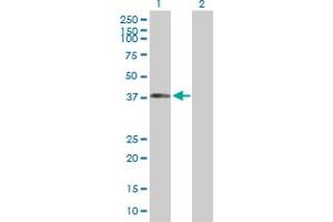 Western Blot analysis of DYNC1H1 expression in transfected 293T cell line by DYNC1H1 MaxPab polyclonal antibody. (DYNC1H1 anticorps  (AA 1-197))