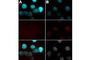Histone H2AX phospho Ser139 antibody tested by immunofluorescence. (H2AFX anticorps  (pSer139))