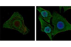 Confocal immunofluorescence analysis of MCF-7 (left) and HepG2 (right) cells using BRAF mouse mAb (green). (BRAF anticorps)