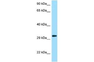 Western Blotting (WB) image for anti-Killer Cell Lectin-Like Receptor Subfamily C, Member 1 (KLRC1) (N-Term) antibody (ABIN2788755) (KLRC1 anticorps  (N-Term))