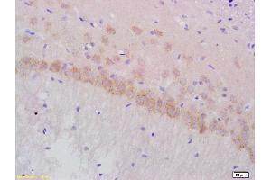 anti-Adaptor-Related Protein Complex 1, gamma 1 Subunit (AP1G1) (AA 721-822) antibody