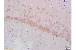 Formalin-fixed and paraffin embedded rat brain labeled with Anti-Gamma-Adaptin Polyclonal Antibody, Unconjugated  at 1:200 followed by conjugation to the secondary antibody and DAB staining (gamma 1 Adaptin anticorps  (AA 721-822))