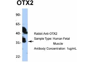 Host:  Rabbit  Target Name:  OTX2  Sample Type:  Human Fetal Muscle  Antibody Dilution:  1. (OTX2 anticorps  (N-Term))