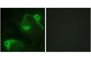 Immunofluorescence analysis of COS7 cells, using VAV2 (Ab-142) Antibody. (VAV2 anticorps  (AA 108-157))