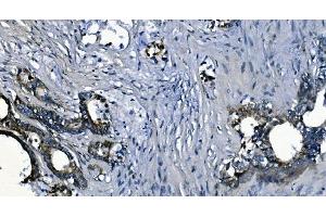 IHC analysis of PCBP2/hnRNP E2 using anti-PCBP2/hnRNP E2 antibody (ABIN7600449). (PCBP2 anticorps  (AA 197-276))