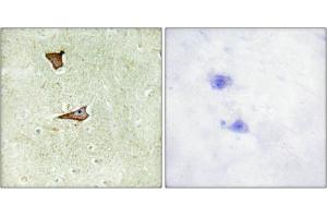 Immunohistochemical analysis of paraffin-embedded human brain tissue using IGF2R (Phospho-Ser2409) antibody (left)or the same antibody preincubated with blocking peptide (right). (IGF2R anticorps  (pSer2409))