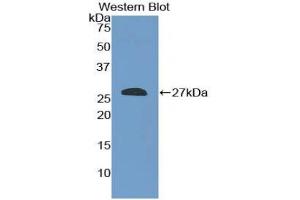 Western blot analysis of the recombinant protein. (SHC2 anticorps  (AA 98-302))